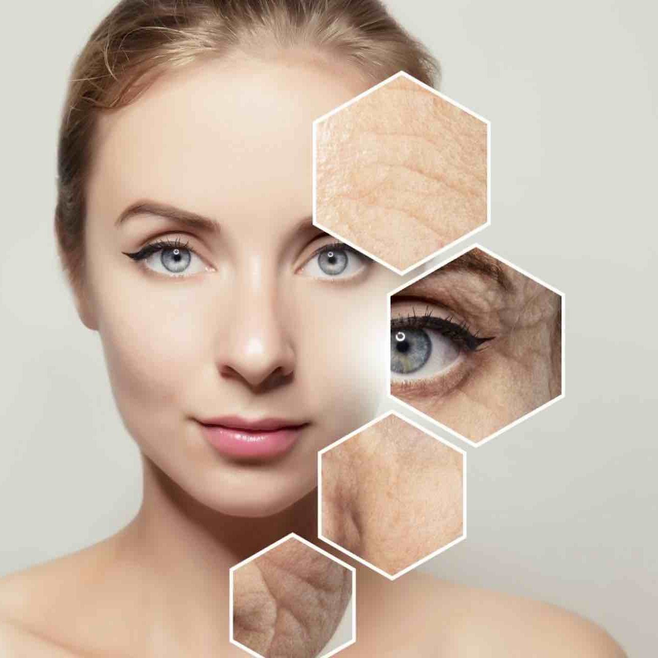 Tái sinh da - giải quyết các vấn đề lão hóa mà da gặp phải