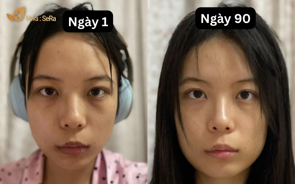 bí quyết chống lão hóa da mặt bí quyết chống lão hóa da mặt